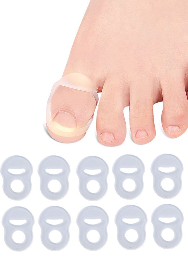 ١٠ قطع من حلقات تصحيح الأظافر الناشبة، حلقات سيليكون لتصحيح الأظافر الناشبة - مقاومة للتمدد، قابلة لإعادة الاستخدام - Image 1